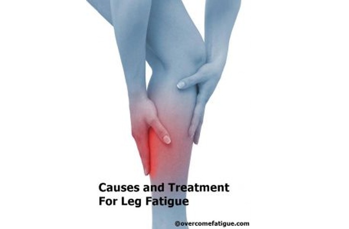 Causes and Treatment For Leg Fatigue