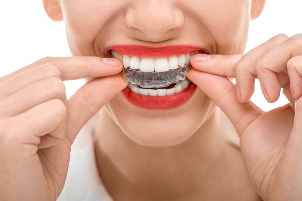 A Guide to Different Types of Teeth Whitening Products